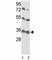 Voltage Dependent Anion Channel 1 antibody, F49743-0.4ML, NSJ Bioreagents, Western Blot image 
