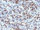 Myogenin antibody, NBP2-44327, Novus Biologicals, Immunohistochemistry frozen image 