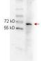 p65 antibody, NBP1-77815, Novus Biologicals, Western Blot image 