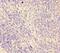 Desmoglein-3 antibody, orb238698, Biorbyt, Immunohistochemistry paraffin image 