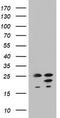ADP Ribosylation Factor Like GTPase 3 antibody, TA803088AM, Origene, Western Blot image 