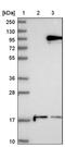 Deltex E3 Ubiquitin Ligase 3L antibody, PA5-52708, Invitrogen Antibodies, Western Blot image 