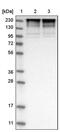 Tumor Protein P53 Binding Protein 1 antibody, PA5-54565, Invitrogen Antibodies, Western Blot image 