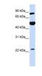Mannosyl-oligosaccharide glucosidase antibody, NBP1-79194, Novus Biologicals, Western Blot image 