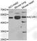 Activin A Receptor Type 1 antibody, A7542, ABclonal Technology, Western Blot image 