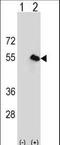 ACBP antibody, LS-C166993, Lifespan Biosciences, Western Blot image 