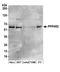 Protein Phosphatase 4 Regulatory Subunit 2 antibody, A300-838A, Bethyl Labs, Western Blot image 
