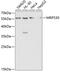 Mitochondrial Ribosomal Protein S30 antibody, GTX54320, GeneTex, Western Blot image 