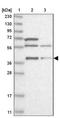 Ring Finger Protein 2 antibody, NBP1-88712, Novus Biologicals, Western Blot image 