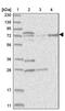 Kelch Like Family Member 17 antibody, PA5-56689, Invitrogen Antibodies, Western Blot image 