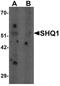 SHQ1, H/ACA Ribonucleoprotein Assembly Factor antibody, PA5-34449, Invitrogen Antibodies, Western Blot image 