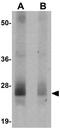 RWD Domain Containing 3 antibody, GTX85245, GeneTex, Western Blot image 