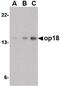 Lag antibody, PA5-20382, Invitrogen Antibodies, Western Blot image 