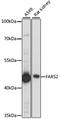 Phenylalanyl-TRNA Synthetase 2, Mitochondrial antibody, LS-C750218, Lifespan Biosciences, Western Blot image 