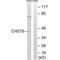 Carbohydrate Sulfotransferase 8 antibody, A10989, Boster Biological Technology, Western Blot image 