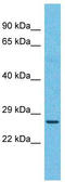 Homeobox protein Nkx-6.2 antibody, TA329659, Origene, Western Blot image 
