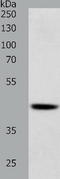 SRY-Box 7 antibody, TA322157, Origene, Western Blot image 
