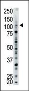 Ubiquitin carboxyl-terminal hydrolase 15 antibody, 61-108, ProSci, Western Blot image 