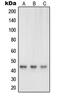 Pro-neuregulin-1, membrane-bound isoform antibody, MBS821906, MyBioSource, Western Blot image 