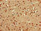PR/SET Domain 16 antibody, LS-C682233, Lifespan Biosciences, Immunohistochemistry paraffin image 