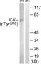 Serine/threonine-protein kinase ICK antibody, LS-C199092, Lifespan Biosciences, Western Blot image 