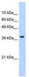 Chromobox 6 antibody, TA343729, Origene, Western Blot image 