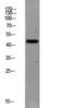 Coagulation Factor II Thrombin Receptor antibody, STJ99660, St John