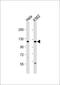 Probable ATP-dependent RNA helicase DDX11 antibody, 55-911, ProSci, Western Blot image 