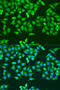 Ribonucleotide Reductase Catalytic Subunit M1 antibody, 14-936, ProSci, Immunofluorescence image 