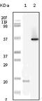 LYN Proto-Oncogene, Src Family Tyrosine Kinase antibody, 32-189, ProSci, Western Blot image 