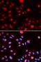 N-Methylpurine DNA Glycosylase antibody, orb167324, Biorbyt, Immunofluorescence image 
