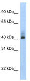 Ankyrin Repeat Domain 42 antibody, TA344032, Origene, Western Blot image 