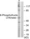 6-Phosphofructo-2-Kinase/Fructose-2,6-Biphosphatase 2 antibody, abx013313, Abbexa, Western Blot image 
