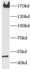 Platelet Derived Growth Factor Receptor Beta antibody, FNab09972, FineTest, Western Blot image 