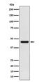 Acetyl-CoA Acetyltransferase 1 antibody, M02008, Boster Biological Technology, Western Blot image 