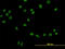 Upstream stimulatory factor 2 antibody, LS-C133513, Lifespan Biosciences, Immunofluorescence image 