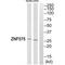 Zinc Finger Protein 575 antibody, A18586, Boster Biological Technology, Western Blot image 