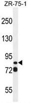 ArfGAP With SH3 Domain, Ankyrin Repeat And PH Domain 3 antibody, AP50266PU-N, Origene, Western Blot image 