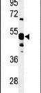 5'-Nucleotidase, Cytosolic IA antibody, PA5-26912, Invitrogen Antibodies, Western Blot image 