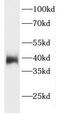ELMO Domain Containing 1 antibody, FNab02743, FineTest, Western Blot image 