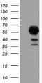 Epoxide Hydrolase 2 antibody, CF501626, Origene, Western Blot image 