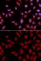 DLG Associated Protein 5 antibody, GTX33253, GeneTex, Immunocytochemistry image 