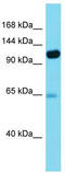Presequence protease, mitochondrial antibody, TA340182, Origene, Western Blot image 