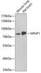 Nephrocystin 1 antibody, 22-397, ProSci, Western Blot image 
