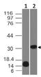 Galectin 13 antibody, M08143, Boster Biological Technology, Western Blot image 