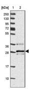 Vesicle Transport Through Interaction With T-SNAREs 1B antibody, NBP2-33414, Novus Biologicals, Western Blot image 