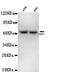 Keratin 7 antibody, LS-C178315, Lifespan Biosciences, Western Blot image 