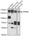 Protein Phosphatase 6 Regulatory Subunit 3 antibody, 16-880, ProSci, Western Blot image 