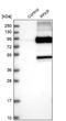 Phosphofructokinase, Platelet antibody, NBP1-92256, Novus Biologicals, Western Blot image 