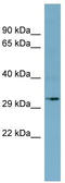 Dehydrogenase/Reductase 11 antibody, TA338653, Origene, Western Blot image 
